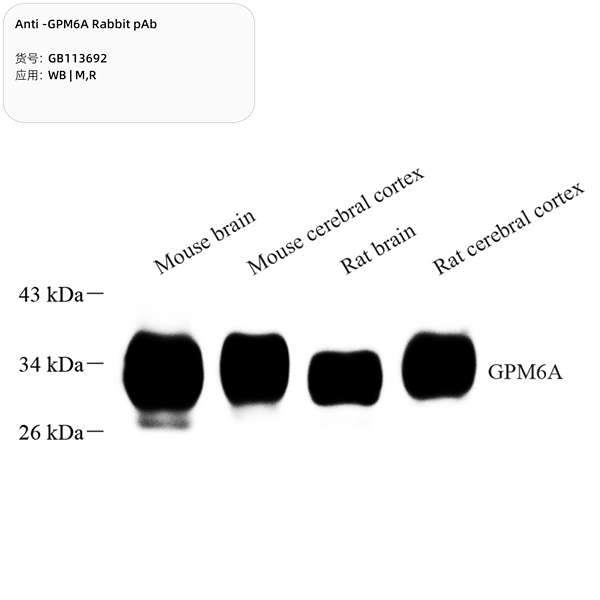 Антитела первичные, поликлональные, GPM6A, 100 мкл