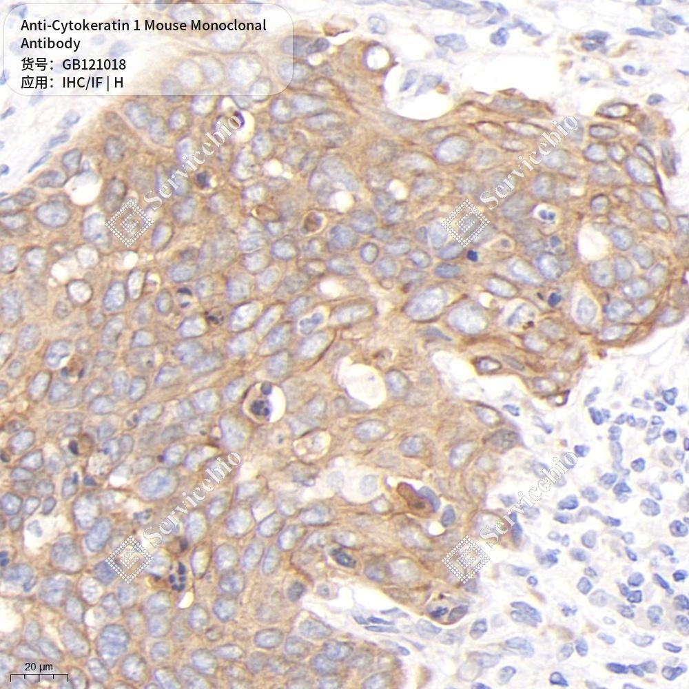 Антитела первичные, моноклональные мыши к Cytokeratin 1 человека, 50 мкл