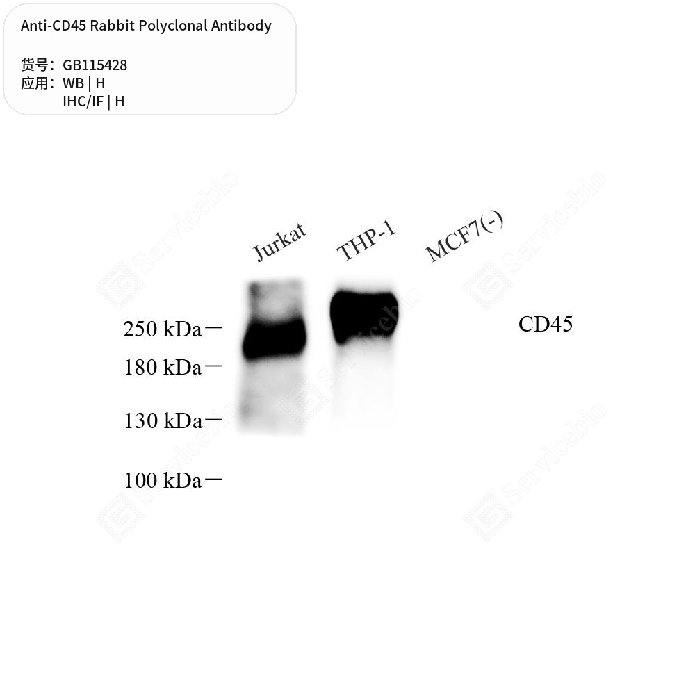 Антитела первичные, поликлональные кролика к CD45 человека, 50 мкл