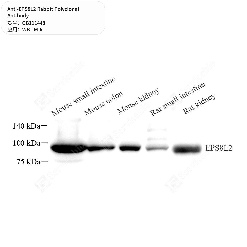 Антитела первичные, поликлональные кролика к EPS8L2 крысы, мыши, 100 мкл