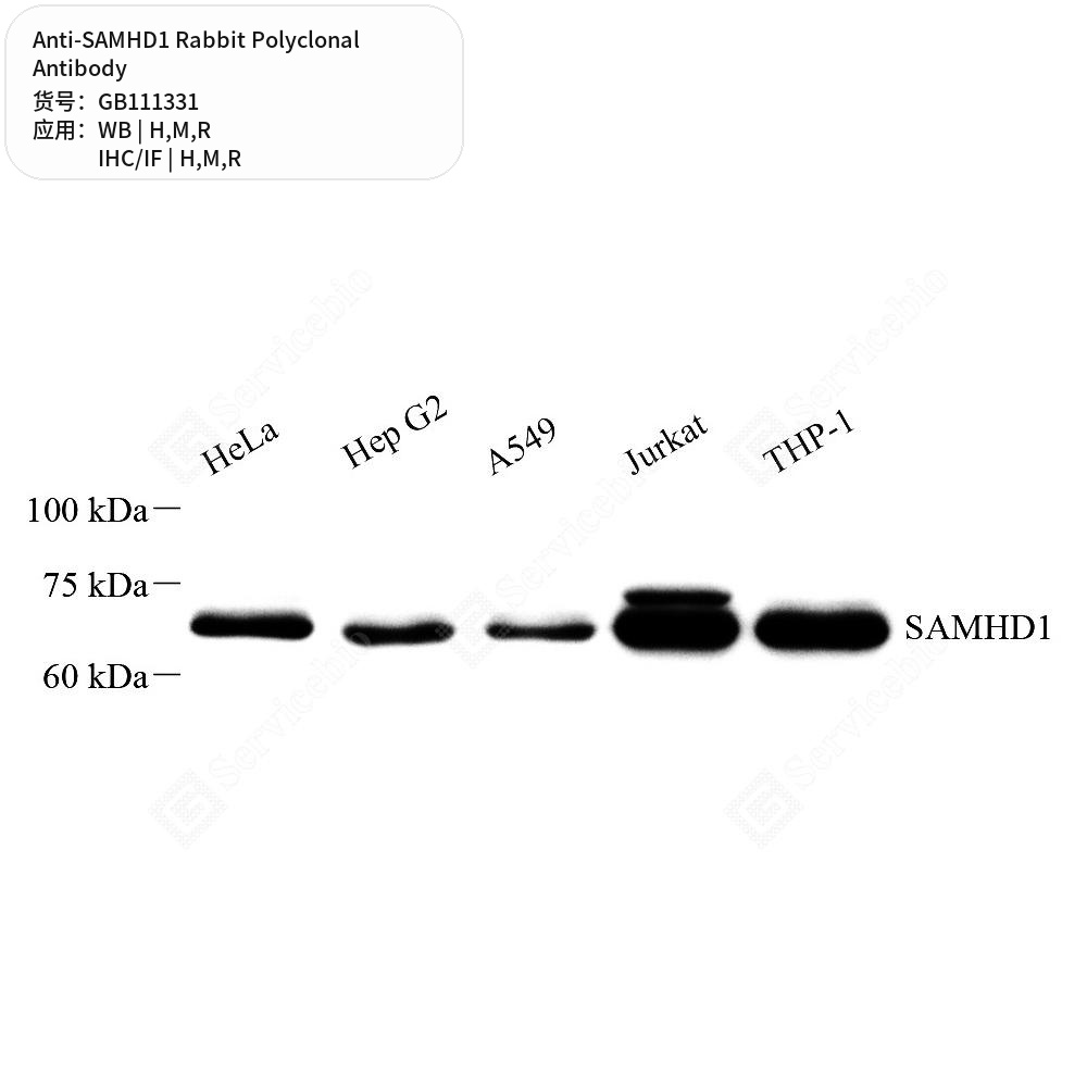 Антитела первичные, поликлональные кролика к SAMHD1 крысы, мыши, человека, 100 мкл