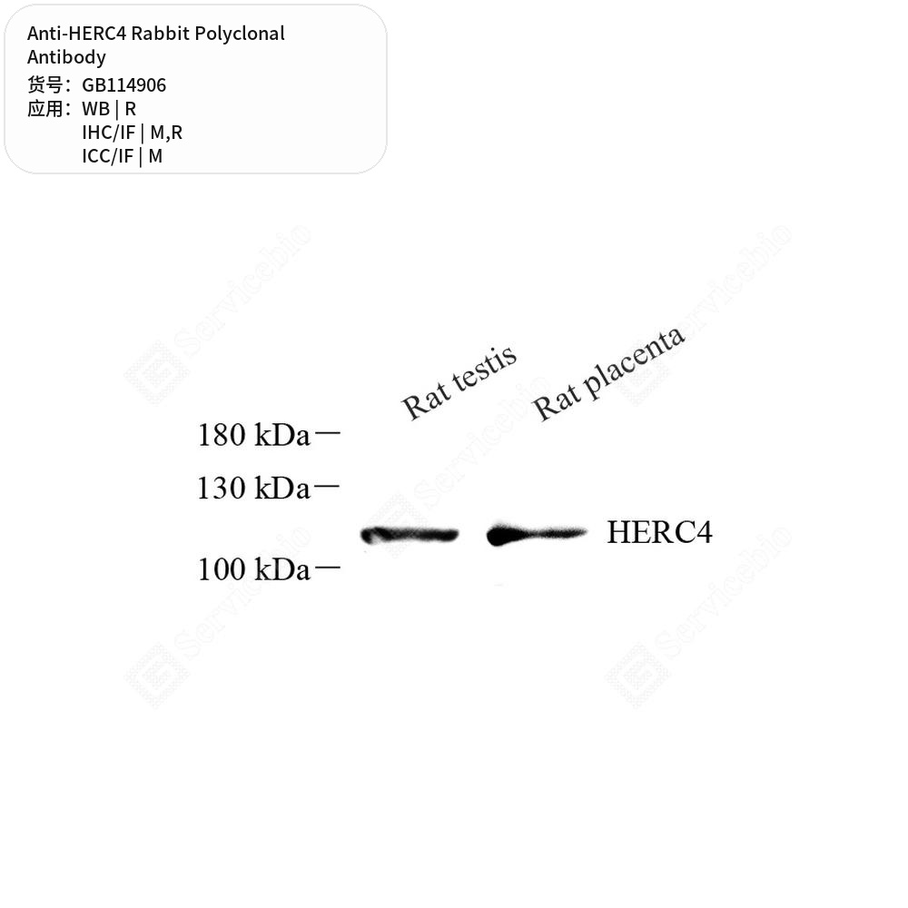 Антитела первичные, поликлональные кролика к HERC4 крысы, мыши, 100 мкл