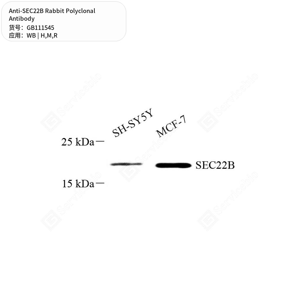 Антитела первичные, поликлональные кролика к SEC22B крысы, мыши, человека, 100 мкл