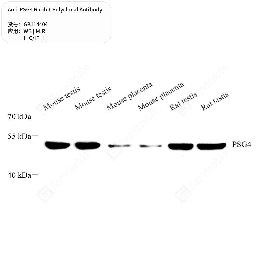 Антитела первичные, поликлональные кролика к PSG4 крысы, мыши, человека, 50 мкл