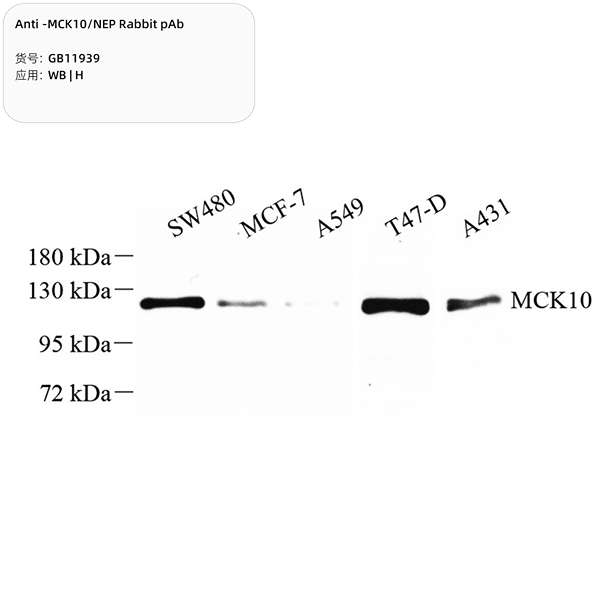 Антитела первичные, поликлональные, MCK10/NEP, 100 мкл