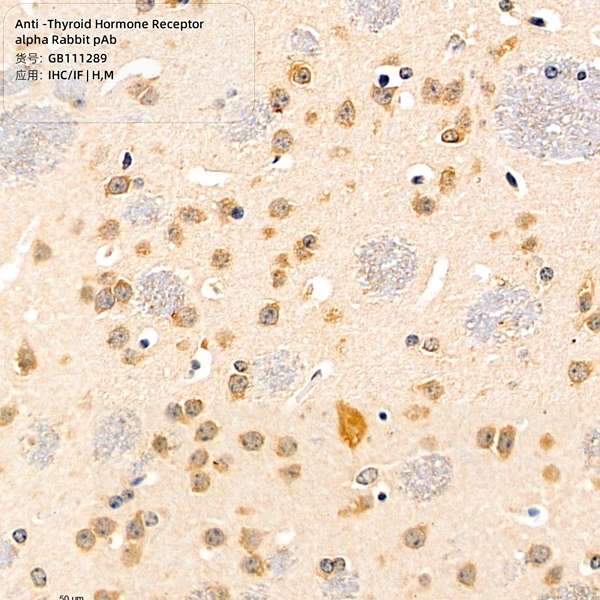 Антитела первичные, поликлональные, Thyroid Hormone Receptor alpha, 100 мкл
