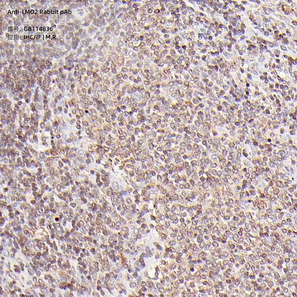 Антитела первичные, поликлональные, LMO2, 100 мкл