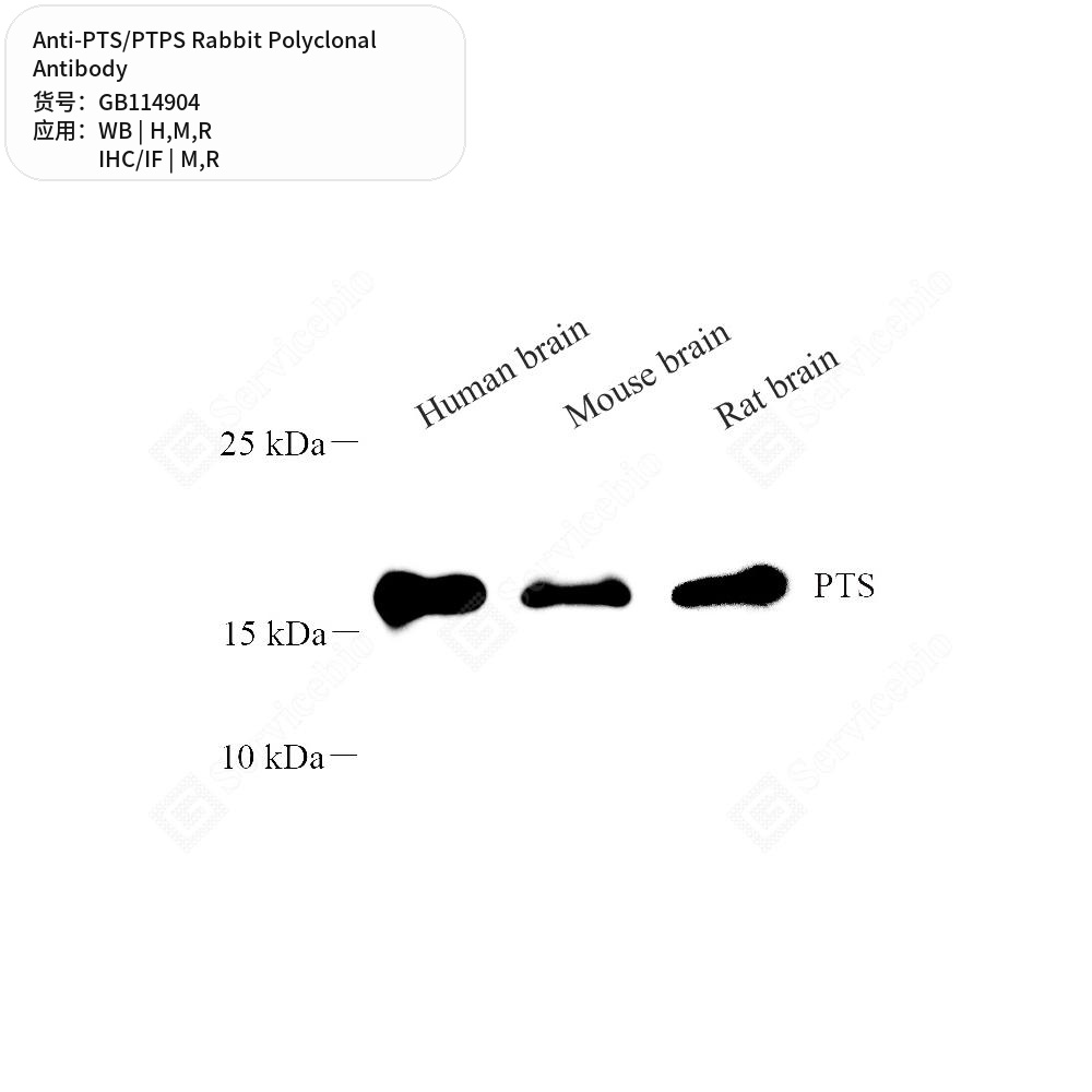 Антитела первичные, поликлональные кролика к PTS/PTPS крысы, мыши, человека, 50 мкл
