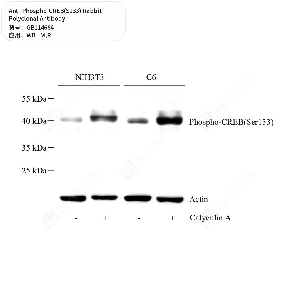 Антитела первичные, поликлональные кролика к Phospho-CREB(S133) крысы, мыши, 50 мкл