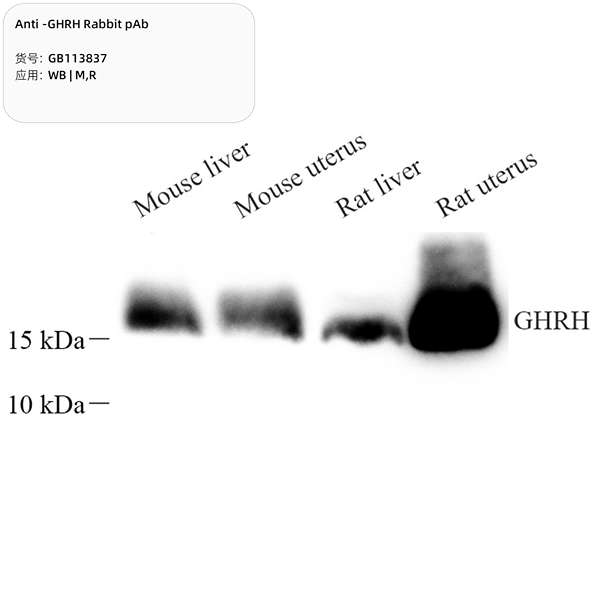 Антитела первичные, поликлональные, GHRH, 100 мкл