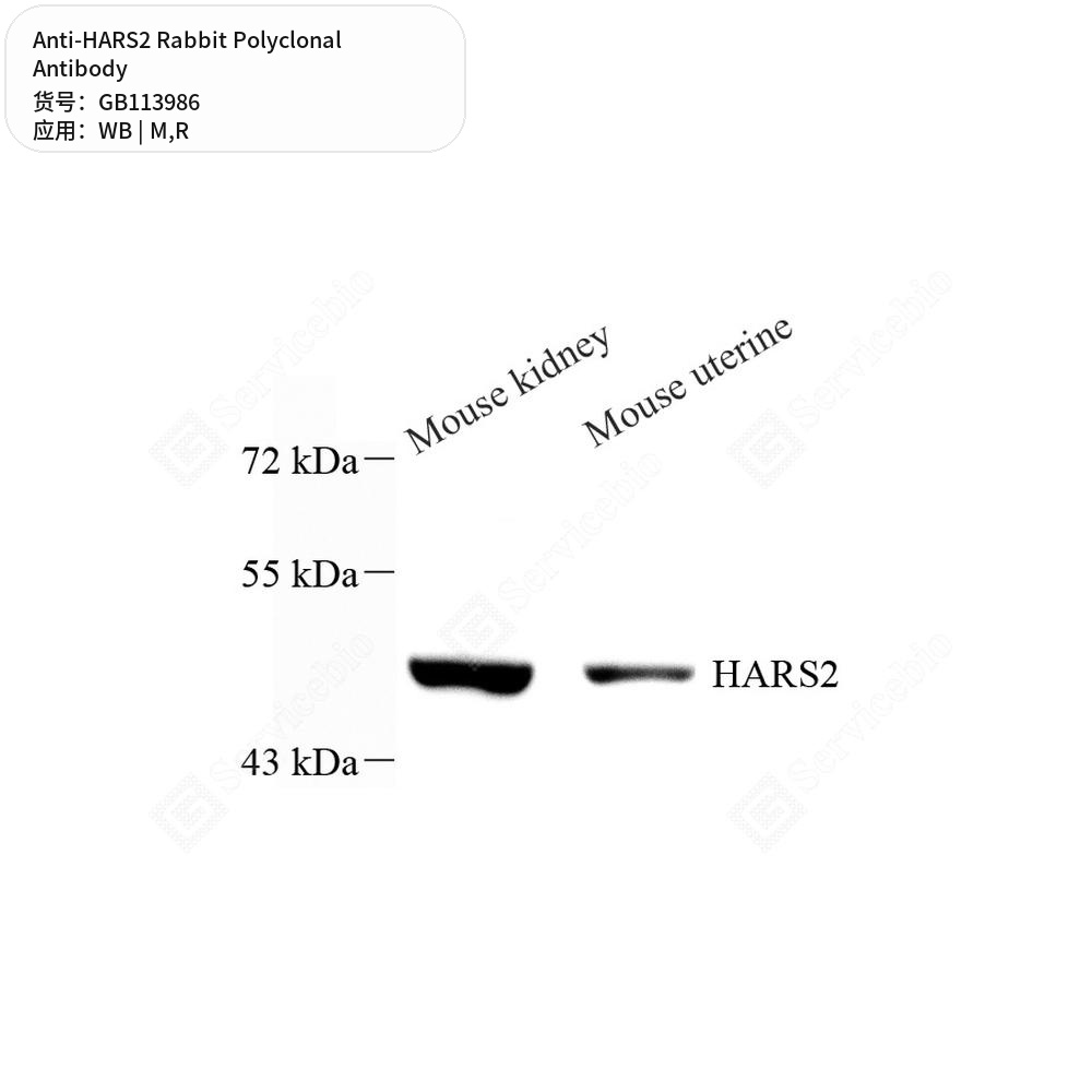 Антитела первичные, поликлональные кролика к HARS2 крысы, мыши, 50 мкл