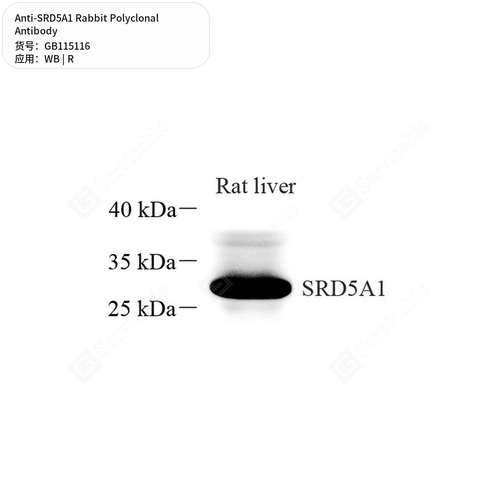 Антитела первичные, поликлональные кролика к SRD5A1 крысы, 50 мкл