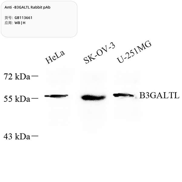 Антитела первичные, поликлональные, B3GALTL, 100 мкл