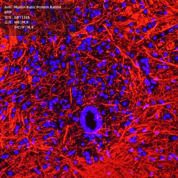 Антитела первичные, поликлональные, Myelin Basic Protein, 100 мкл