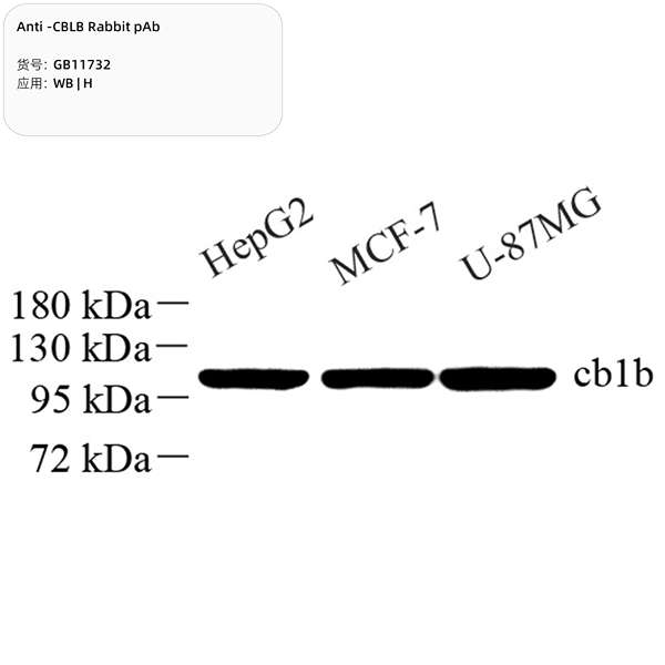 Антитела первичные, поликлональные, CBLB, 100 мкл