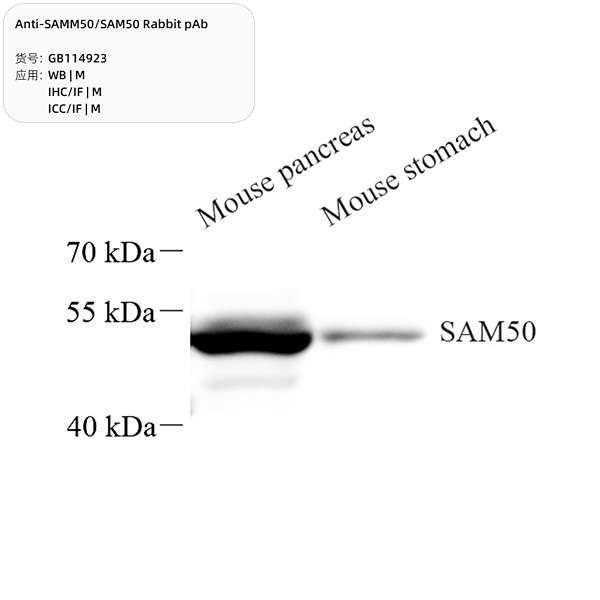 Антитела первичные, поликлональные, SAMM50/SAM50, 100 мкл