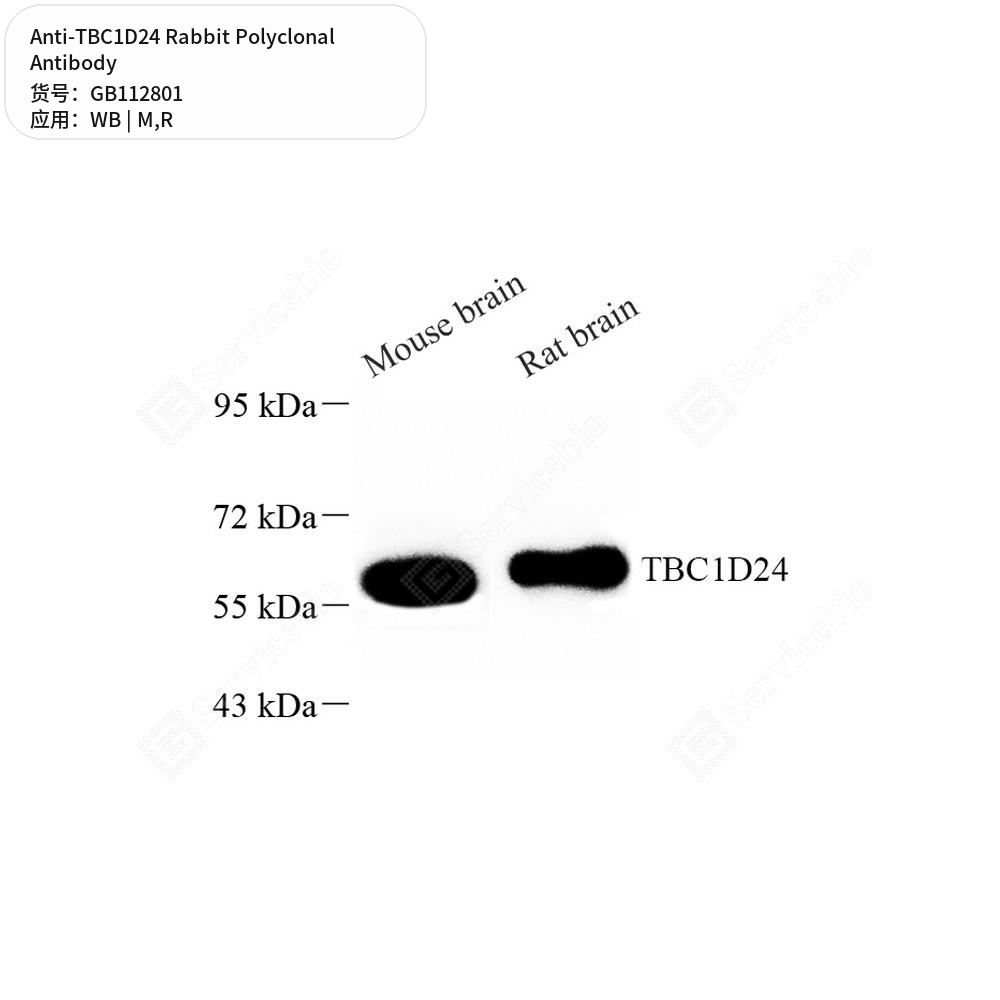 Антитела первичные, поликлональные кролика к TBC1D24 крысы, мыши, 100 мкл