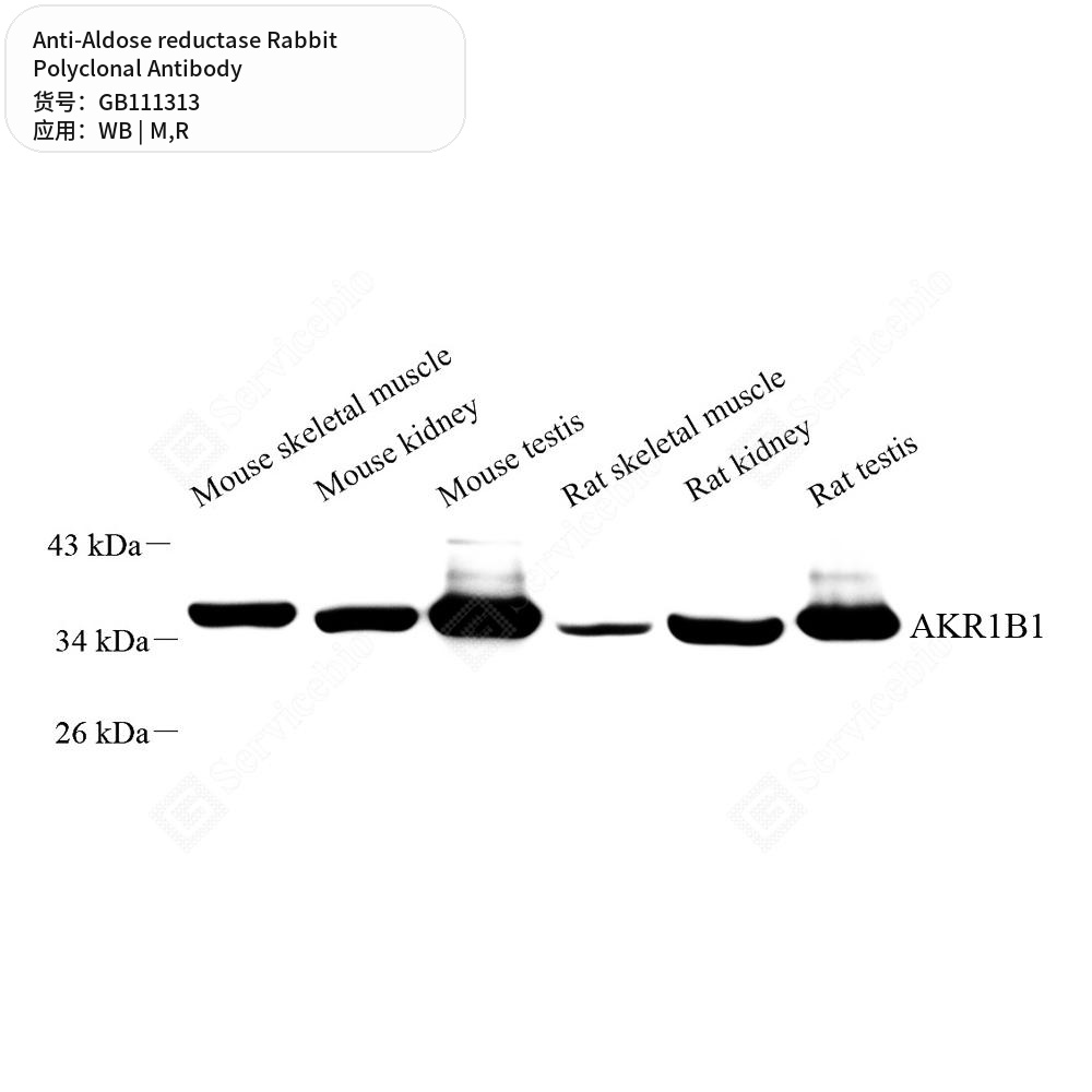 Антитела первичные, поликлональные кролика к Aldose reductase крысы, мыши, 100 мкл