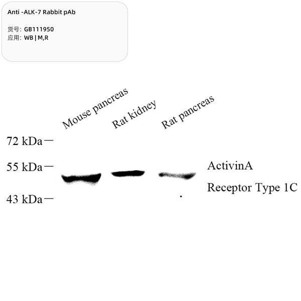 Антитела первичные, поликлональные, ALK-7, 100 мкл