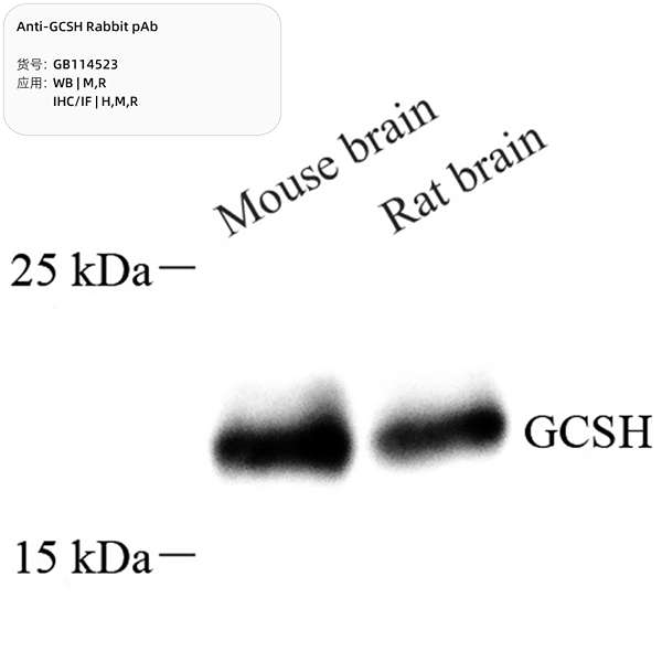Антитела первичные, поликлональные, GCSH, 100 мкл