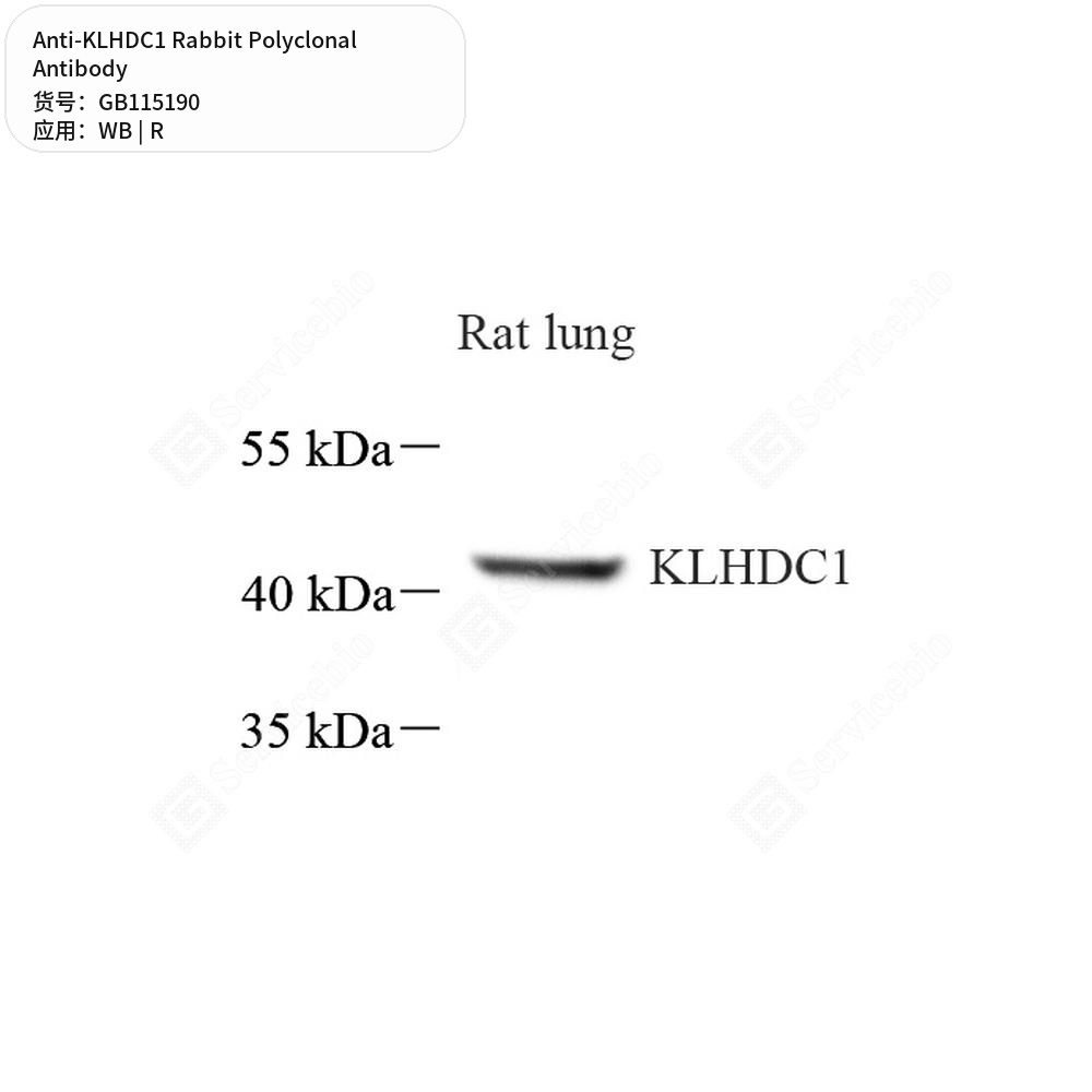 Антитела первичные, поликлональные кролика к KLHDC1 крысы, 100 мкл