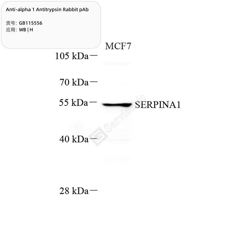 Антитела первичные, поликлональные, alpha 1 Antitrypsin, 100 мкл