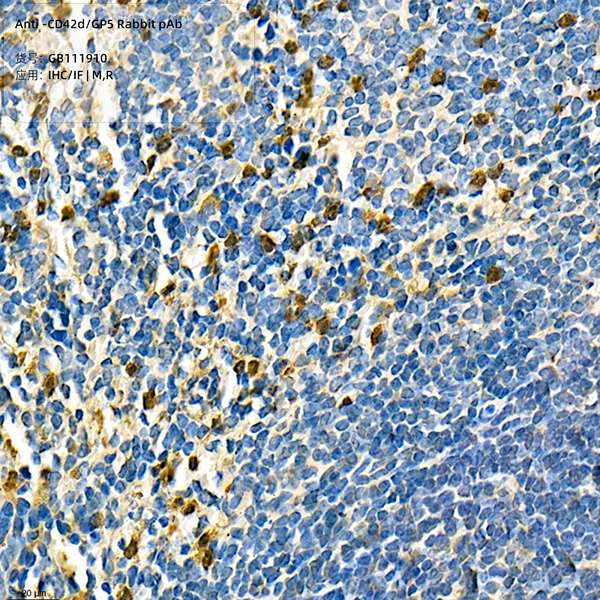 Антитела первичные, поликлональные, CD42d/GP5, 100 мкл