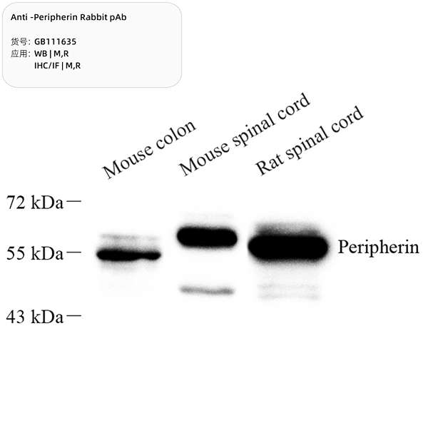 Антитела первичные, поликлональные, Peripherin, 100 мкл