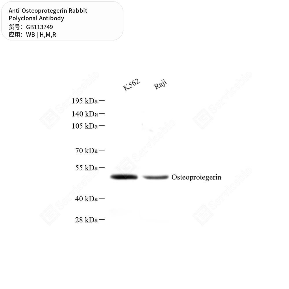 Антитела первичные, поликлональные кролика к Osteoprotegerin крысы, мыши, человека, 100 мкл