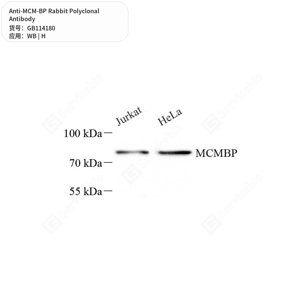 Антитела первичные, поликлональные кролика к MCM-BP человека, 50 мкл