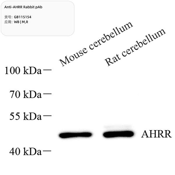 Антитела первичные, поликлональные, AHRR, 100 мкл