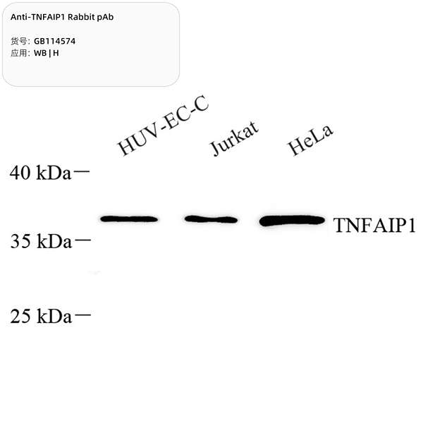 Антитела первичные, поликлональные, TNFAIP1, 100 мкл