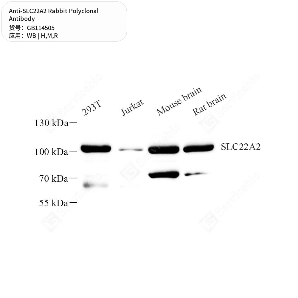 Антитела первичные, поликлональные кролика к SLC22A2 крысы, мыши, человека, 50 мкл