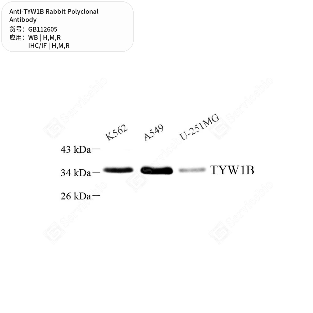 Антитела первичные, поликлональные кролика к TYW1B крысы, мыши, человека, 100 мкл