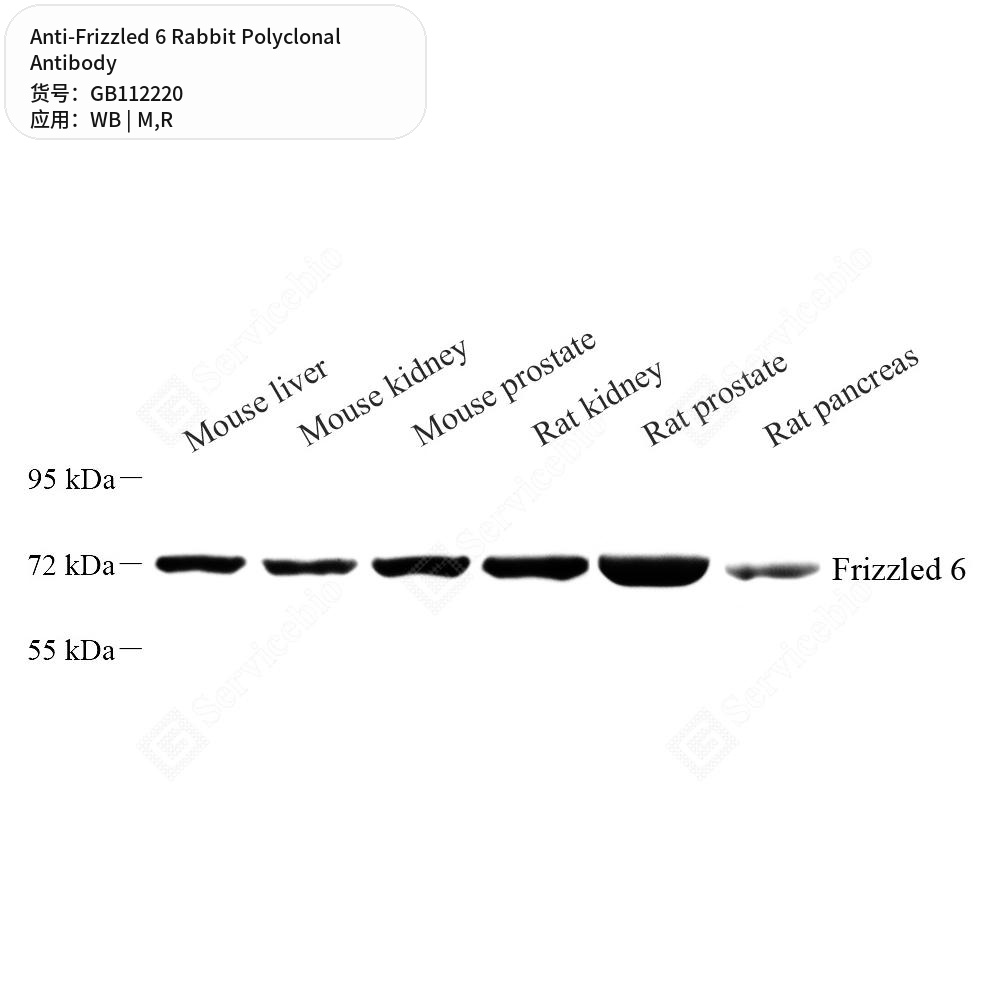 Антитела первичные, поликлональные кролика к Frizzled 6 крысы, мыши, 100 мкл