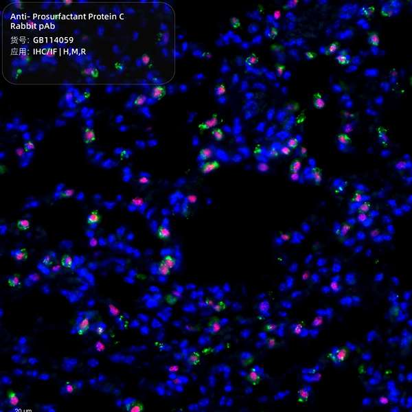 Антитела первичные, поликлональные, Prosurfactant Protein C, 100 мкл