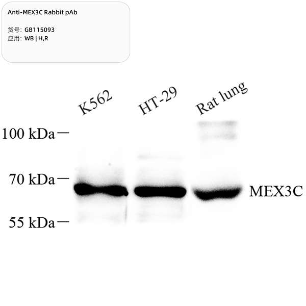 Антитела первичные, поликлональные, MEX3C, 100 мкл