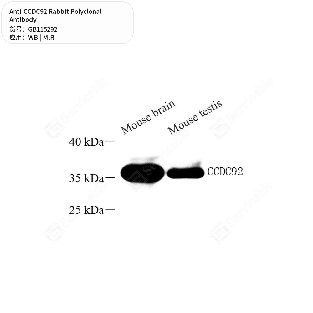 Антитела первичные, поликлональные кролика к CCDC92 крысы, мыши, 50 мкл