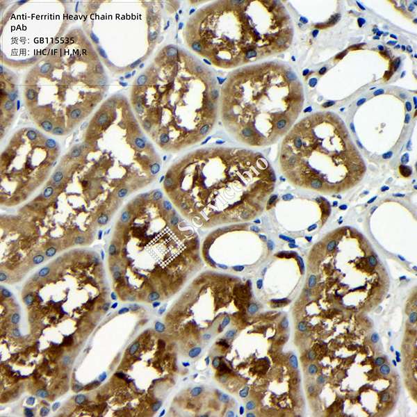 Антитела первичные, поликлональные, Ferritin Heavy Chain, 100 мкл