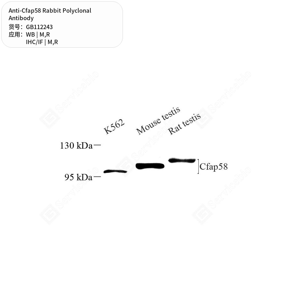 Антитела первичные, поликлональные кролика к Cfap58 крысы, мыши, 100 мкл