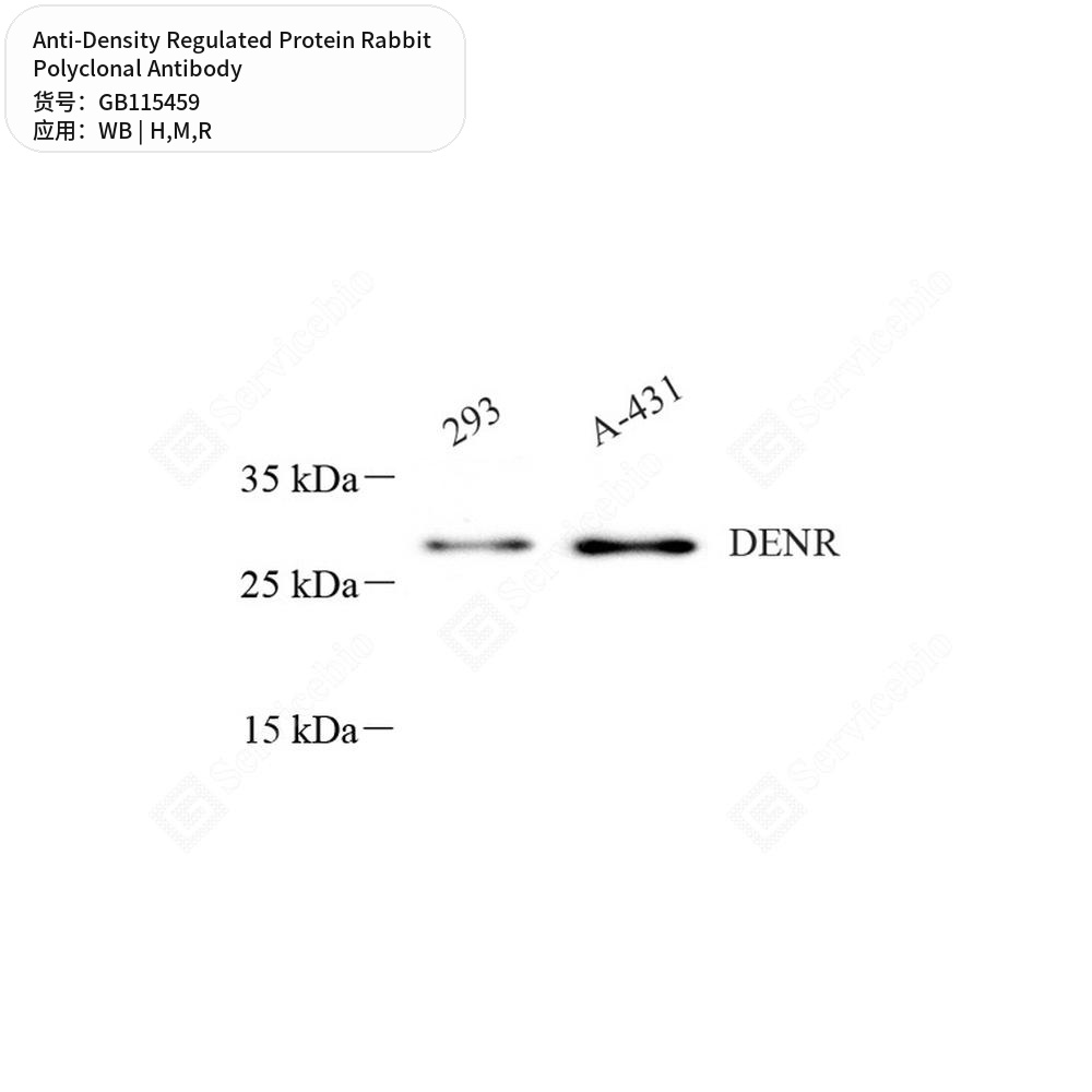 Антитела первичные, поликл. кролика к Density Regulated Protein крысы, мыши, человека, 50 мкл