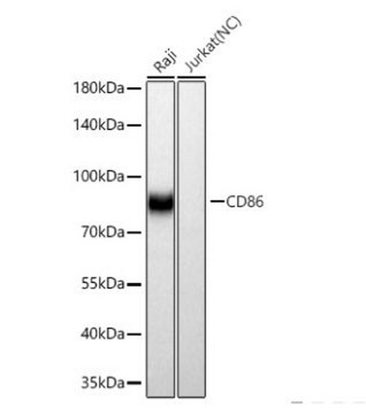 Антитела первичные, моноклональные кролика к CD86 человека, 100 мкл