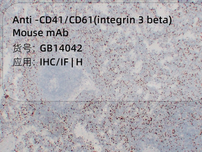 Антитела первичные, моноклональные мыши к CD41/CD61(integrin 3 beta) человека, 50 мкл