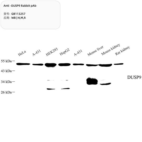 Антитела первичные, поликлональные, DUSP9, 100 мкл