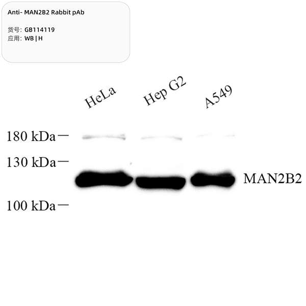 Антитела первичные, поликлональные, MAN2B2, 100 мкл