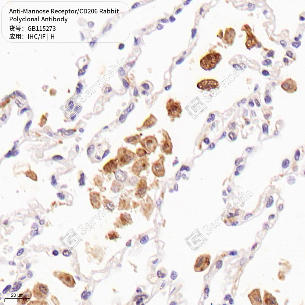 Антитела первичные, поликлональные кролика к Mannose Receptor/CD206 человека, 50 мкл
