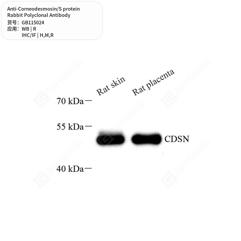 Антитела первичные, поликл. кролика к Corneodesmosin/S protein крысы, мыши, человека, 100 мкл