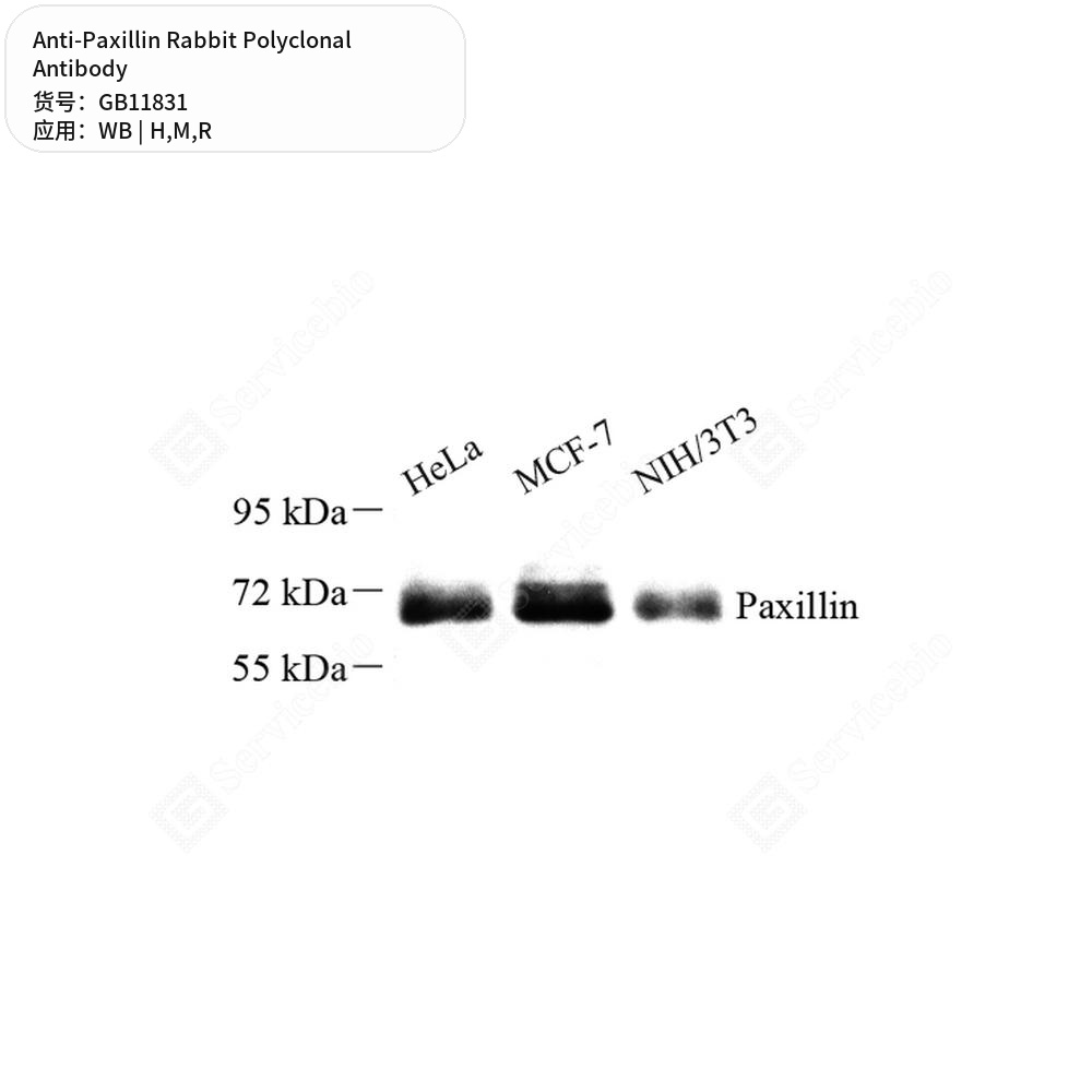 Антитела первичные, поликлональные кролика к Paxillin крысы, мыши, человека, 50 мкл