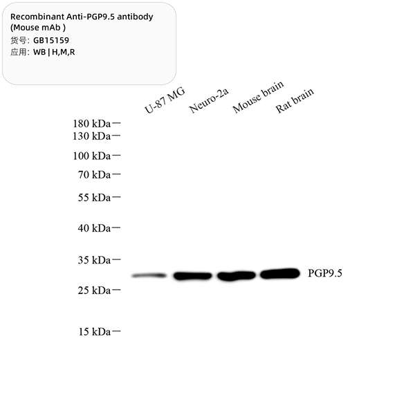 Антитела первичные, моноклональные, PGP9.5, 100 мкл