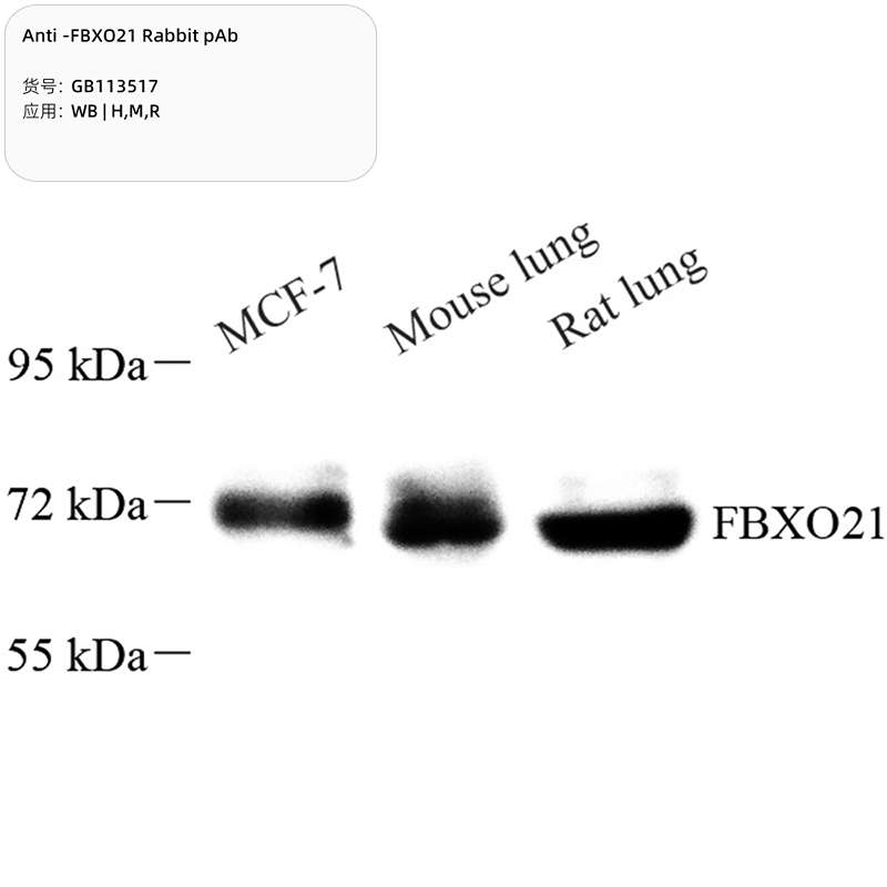 Антитела первичные, поликлональные, FBXO21, 100 мкл